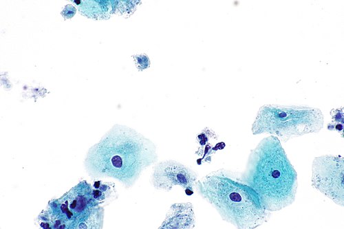 Trichomonas - Pap - 2 -- very high mag.jpg