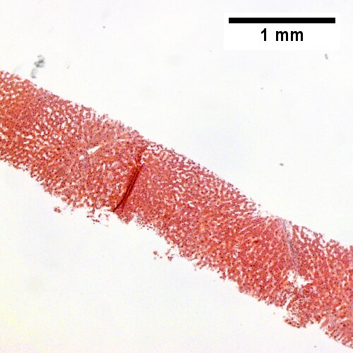 Sinusoidal dilatation, circular spaces of hepatocytes, small portal triads(40X).