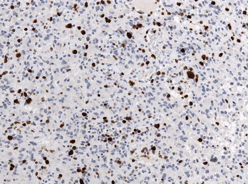 Neuropathology case IX 06.jpg