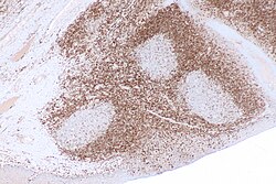 Control tissue
