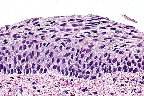 Atrophic cervix - 2 -- very high mag.jpg