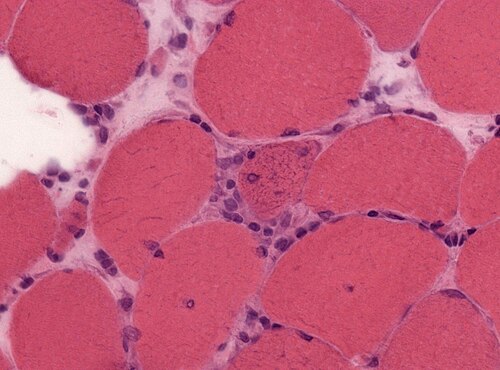 Neuropathology case XII 02.jpg