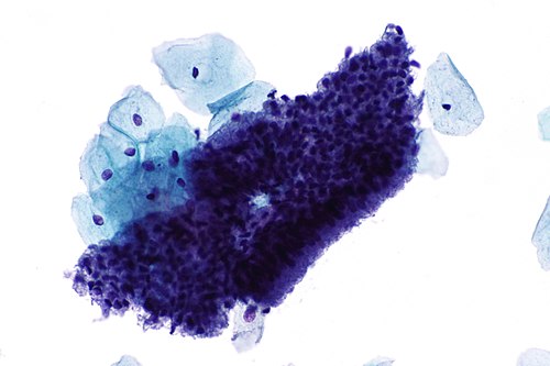 Benign endocervical epithelium - 2 - alt -- high mag.jpg