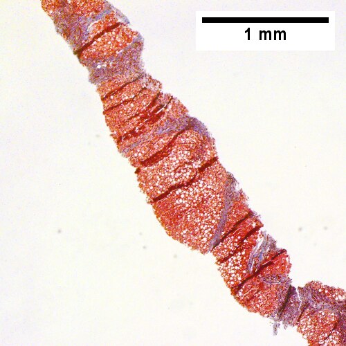 Trichrome shows extensive bridges (Row 1 Right 40X).