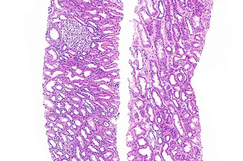 Benign kidney - alt -- low mag.jpg