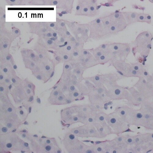 PAS with diastase shows flat lining (400X).