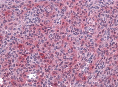 Neuropathology case VII 06.jpg