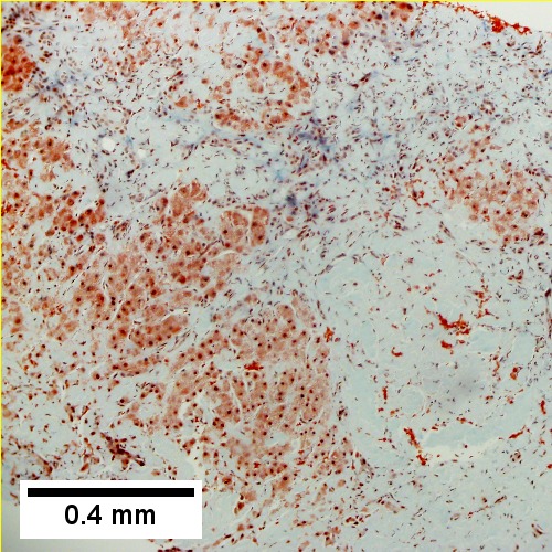 Material barely stains blue on trichrome [10X]