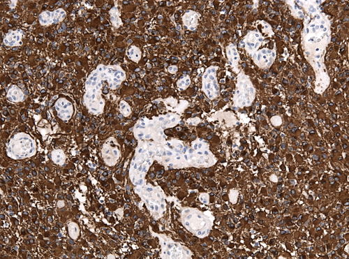 Neuropathology case IX 04.jpg