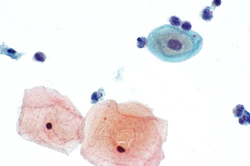 Navicular cell - alt -- very high mag.jpg