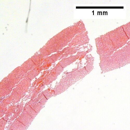 One liver core was normal (Row 1 Left 40X).