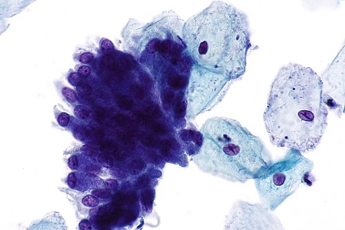 Benign endocervical epithelium - 3 -- very high mag.jpg