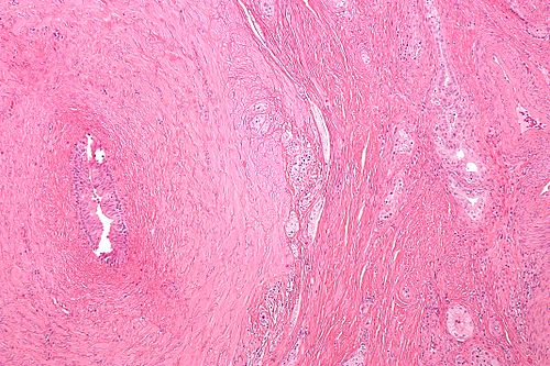 Vasitis nodosa -12- intermed mag.jpg