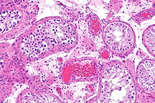 ITGCN and Sertoli cells only -- intermed mag.jpg