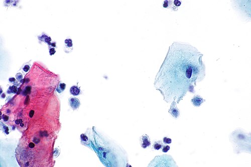 Trichomonas - Pap - 3 -- very high mag.jpg