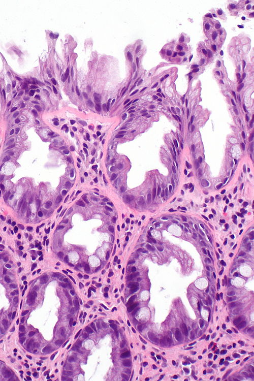Hyperplastic polyp -- high mag.jpg