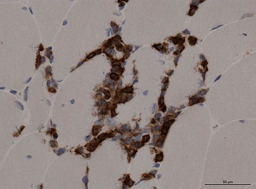 Neuropathology case XII 03.jpg